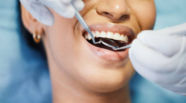 Best Emergency Broken Tooth Repair in Portland, TX